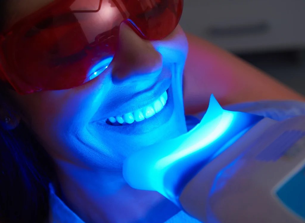 Sbiancamento Denti Fai Da Te: Funziona Davvero? 1 sbiancamento denti fai da te